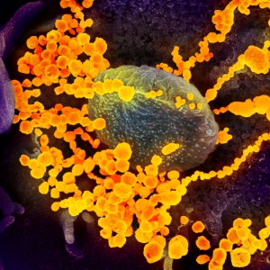 Novel Coronavirus SARS-CoV-2–This scanning electron microscope image shows SARS-CoV-2 (round gold objects) emerging from the surface of cells cultured in the lab. SARS-CoV-2, also known as 2019-nCoV, is the virus that causes COVID-19. Original image sourced from US Government department: The National Institute of Allergy and Infectious Diseases. Under US law this image is copyright free, please credit the government department whenever you can”.