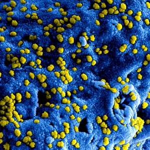 MERS Coronavirus Particles–Colorized scanning electron micrograph of Middle East Respiratory Syndrome virus particles attached to the surface of an infected VERO E6 cell. Original image sourced from US Government department: The National Institute of Allergy and Infectious Diseases. Under US law this image is copyright free, please credit the government department whenever you can”.