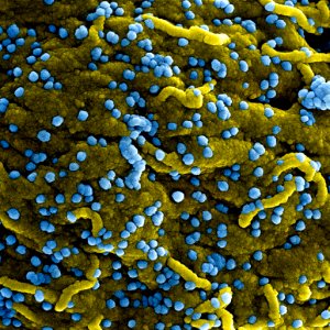 MERS Coronavirus Particles–Colorized scanning electron micrograph of Marburg virus particles (blue) both budding and attached to the surface of infected VERO E6 cells (yellow). Original image sourced from US Government department: The National Institute of Allergy and Infectious Diseases. Under US law this image is copyright free, please credit the government department whenever you can”. photo