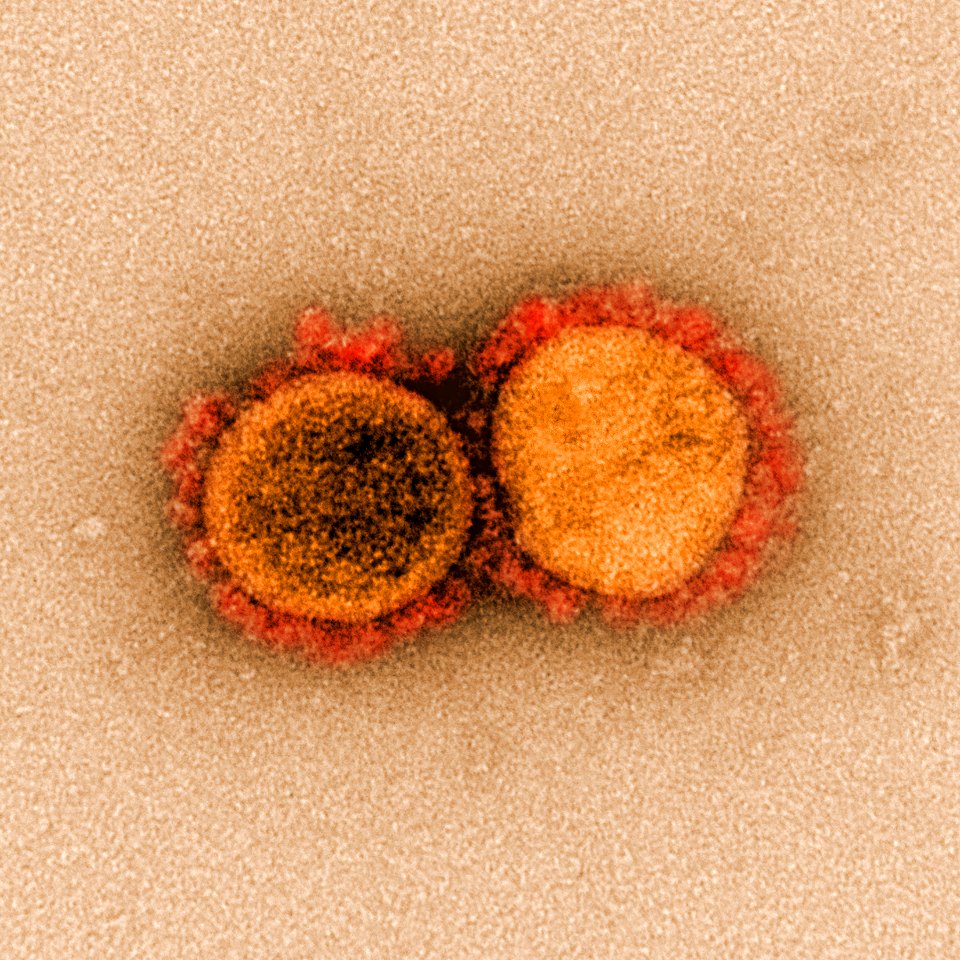 Novel Coronavirus SARS-CoV-2–Transmission electron micrograph of SARS-CoV-2 virus particles, isolated from a patient. Original image sourced from US Government department: The National Institute of Allergy and Infectious Diseases. Under US law this image is copyright free, please credit the government department whenever you can”.