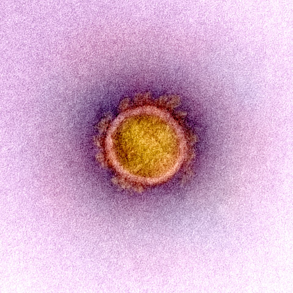 Novel Coronavirus SARS-CoV-2–Transmission electron micrograph of SARS-CoV-2 virus particles, isolated from a patient. Original image sourced from US Government department: The National Institute of Allergy and Infectious Diseases. Under US law this image is copyright free, please credit the government department whenever you can”.