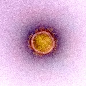 Novel Coronavirus SARS-CoV-2–Transmission electron micrograph of SARS-CoV-2 virus particles, isolated from a patient. Original image sourced from US Government department: The National Institute of Allergy and Infectious Diseases. Under US law this image is copyright free, please credit the government department whenever you can”.