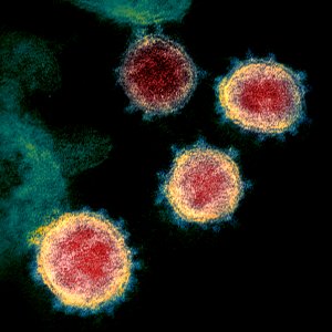 Novel Coronavirus SARS-CoV-2–This scanning electron microscope image shows SARS-CoV-2—also known as 2019-nCoV, the virus that causes COVID-19. Original image sourced from US Government department: The National Institute of Allergy and Infectious Diseases. Under US law this image is copyright free, please credit the government department whenever you can”.