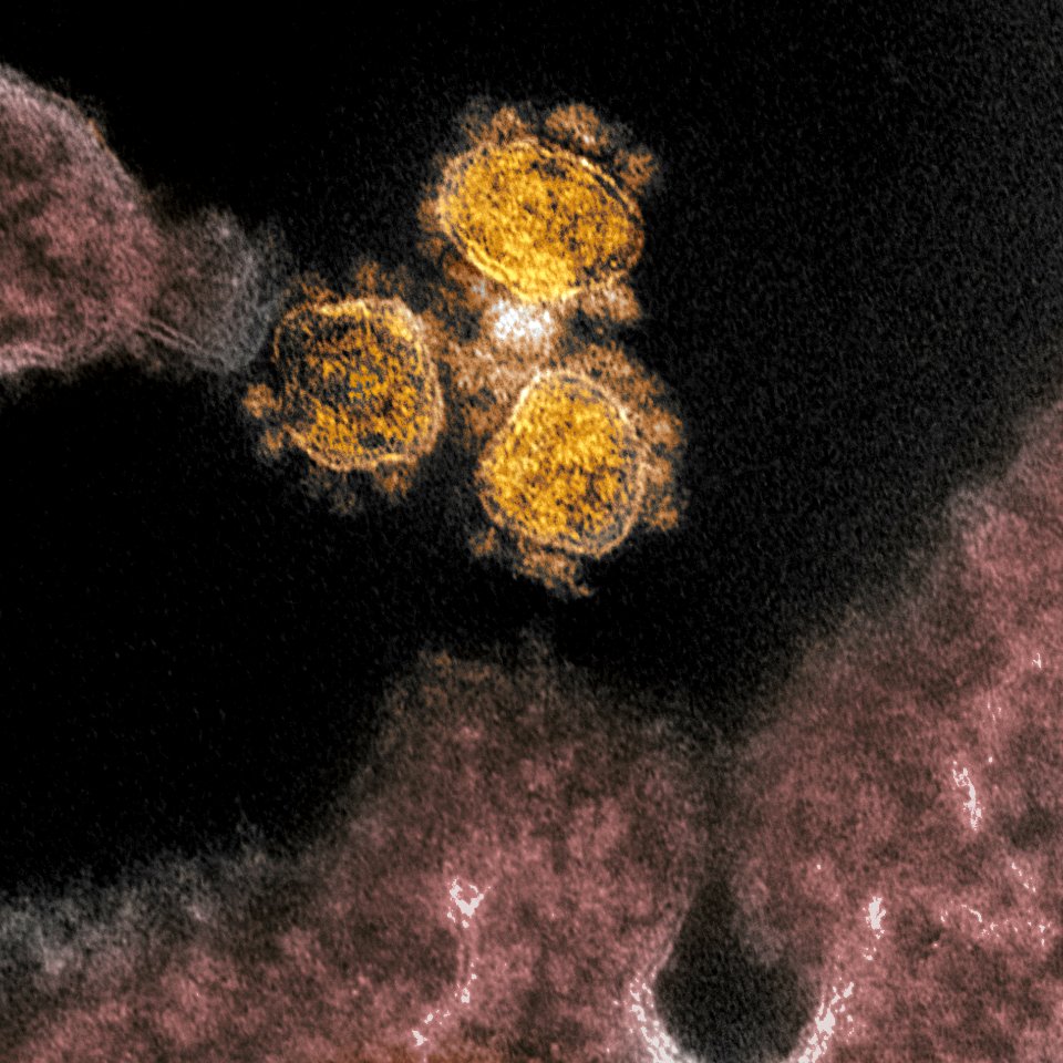 Novel Coronavirus SARS-CoV-2–This transmission electron microscope image shows SARS-CoV-2, the virus that causes COVID-19, Original image sourced from US Government department: The National Institute of Allergy and Infectious Diseases. Under US law this image is copyright free, please credit the government department whenever you can”.