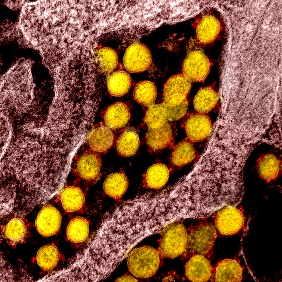 Novel Coronavirus SARS-CoV-2–Transmission electron micrograph of SARS-CoV-2 virus particles, isolated from a patient. Original image sourced from US Government department: The National Institute of Allergy and Infectious Diseases. Under US law this image is copyright free, please credit the government department whenever you can”. photo