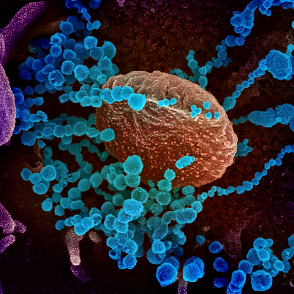 Novel Coronavirus SARS-CoV-2
This scanning electron microscope image shows SARS-CoV-2 (round blue objects) emerging from the surface of cells cultured in the lab. SARS-CoV-2, also known as 2019-nCoV, is the virus that causes COVID-19. Original image sourced from US Government department: The National Institute of Allergy and Infectious Diseases. Under US law this image is copyright free, please credit the government department whenever you can”.