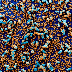 Novel Coronavirus SARS-CoV-2–Colorized scanning electron micrograph of a VERO E6 cell (blue) heavily infected with SARS-COV-2 virus particles (orange), isolated from a patient sample. Original image sourced from US Government department: The National Institute of Allergy and Infectious Diseases. Under US law this image is copyright free, please credit the government department whenever you can”.