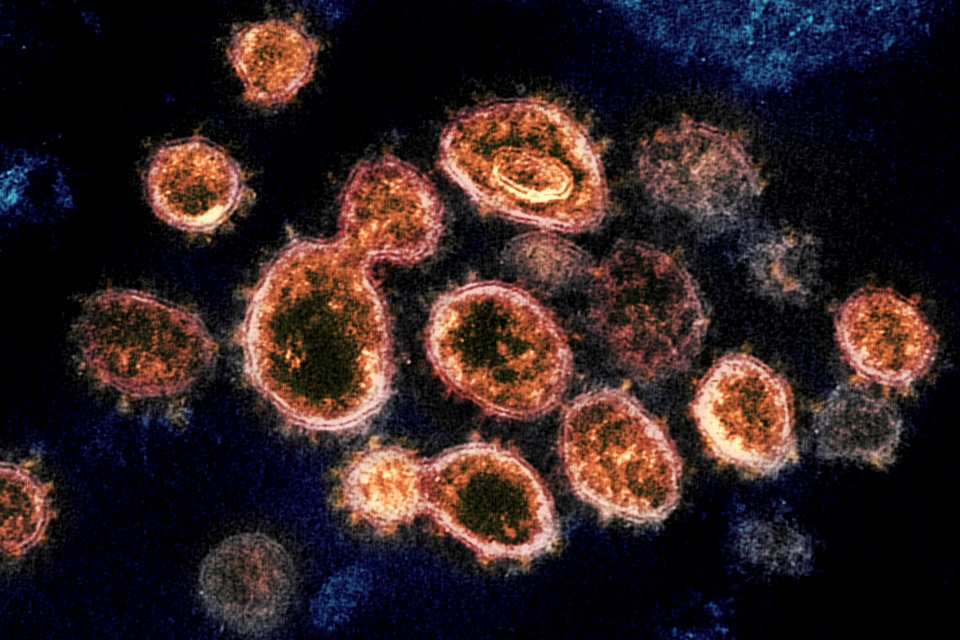 Novel Coronavirus SARS-CoV-2–This transmission electron microscope image shows SARS-CoV-2, the virus that causes COVID-19. Original image sourced from US Government department: The National Institute of Allergy and Infectious Diseases. Under US law this image is copyright free, please credit the government department whenever you can”.