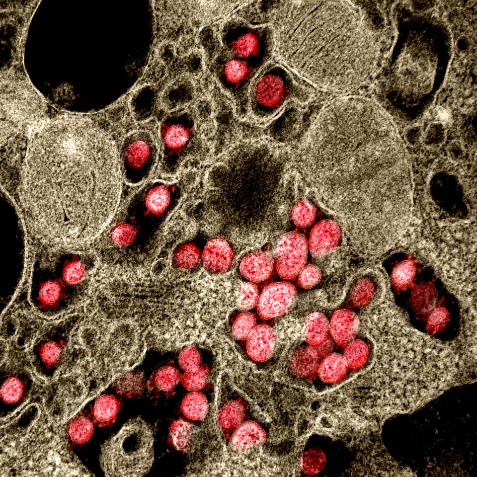 Novel Coronavirus SARS-CoV-2–Transmission electron micrograph of SARS-CoV-2 virus particles, isolated from a patient. Original image sourced from US Government department: The National Institute of Allergy and Infectious Diseases. Under US law this image is copyright free, please credit the government department whenever you can”.