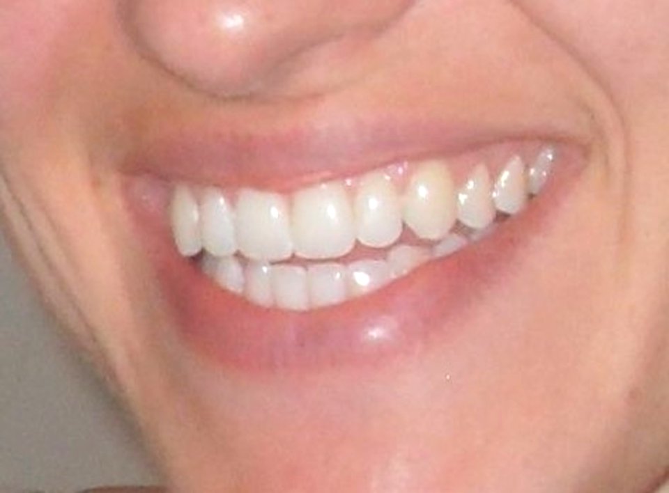 Big Beautiful Smile 2