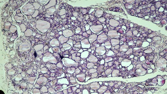 Parafollicular Cells at the Periphery Human Thyroid Gland photo