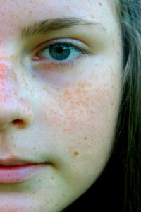 Freckle face portrait blue eyes
