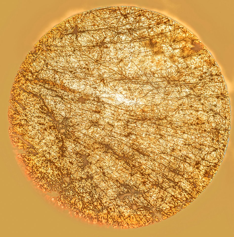 Light On Neuronal Cell