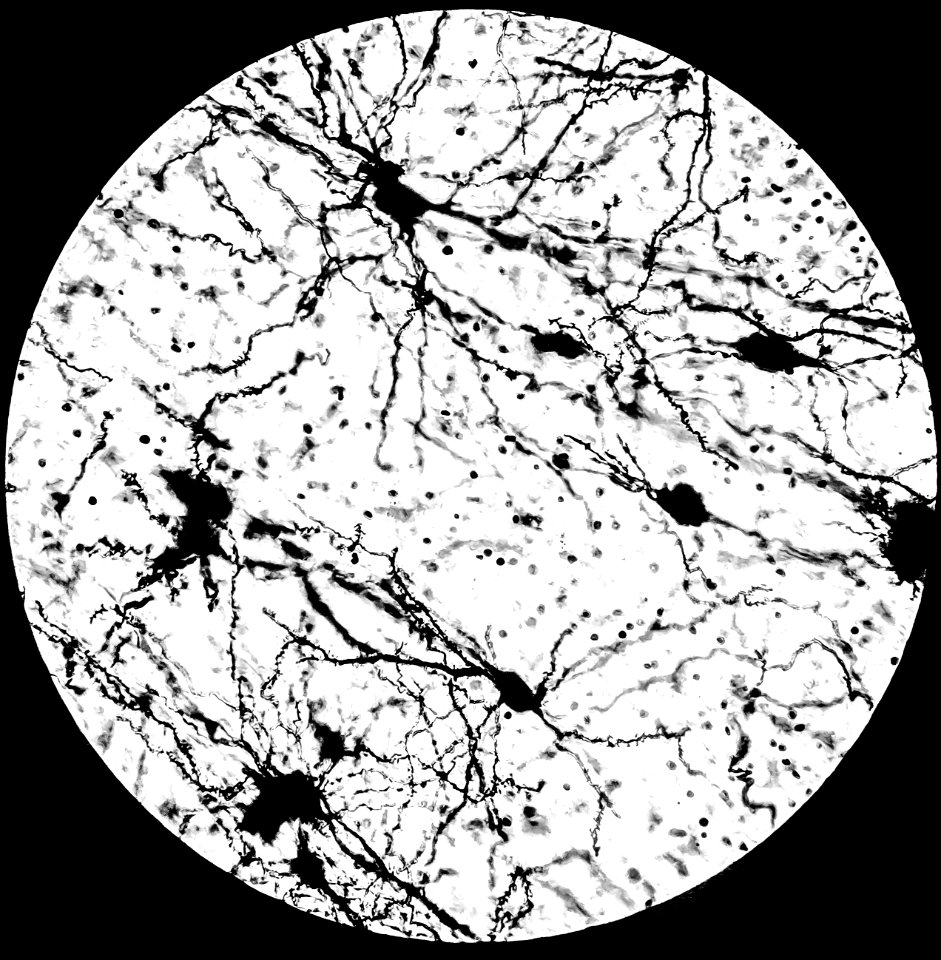 Shade On Neuronal Cell