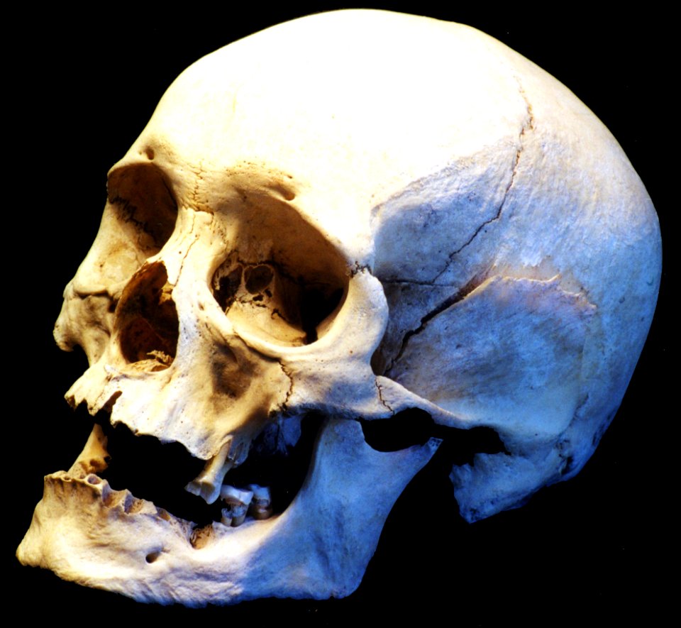 human skull, side view