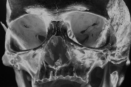 solarized closeup of human skull photo