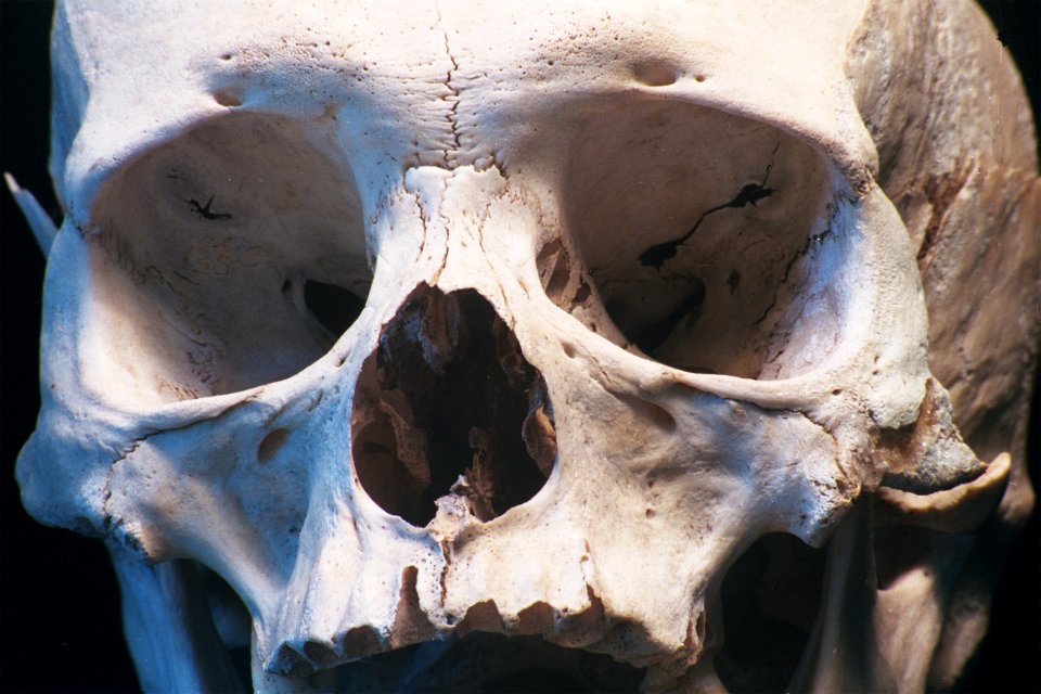 human skull, closeup view