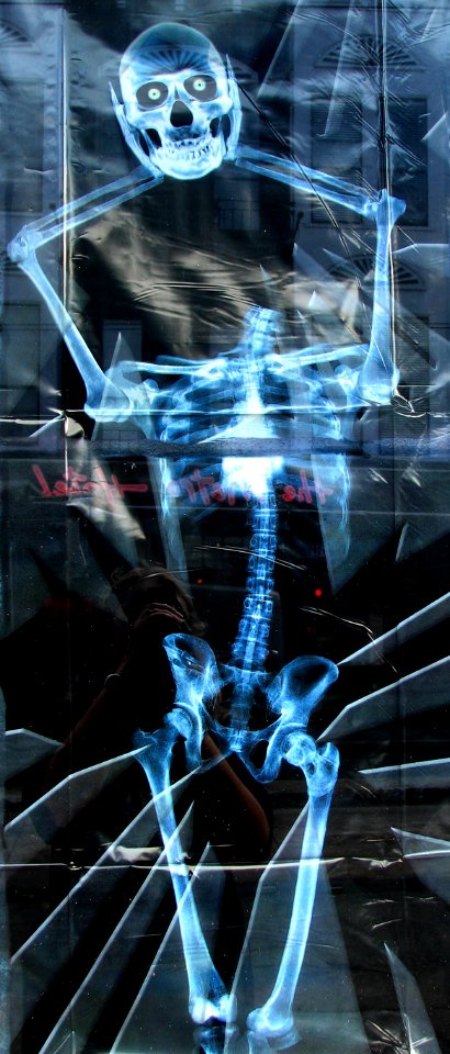 skeleton loses his head
