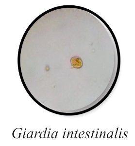 Giardia intestinalis 1