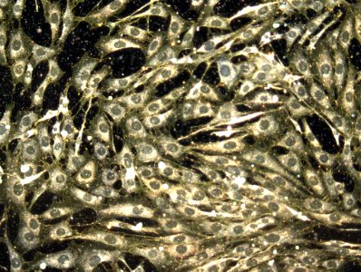 Gold Nanoparticles in Cell Cytosol photo