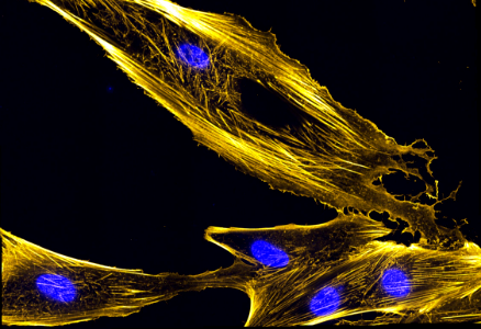 Cytoskeleton photo