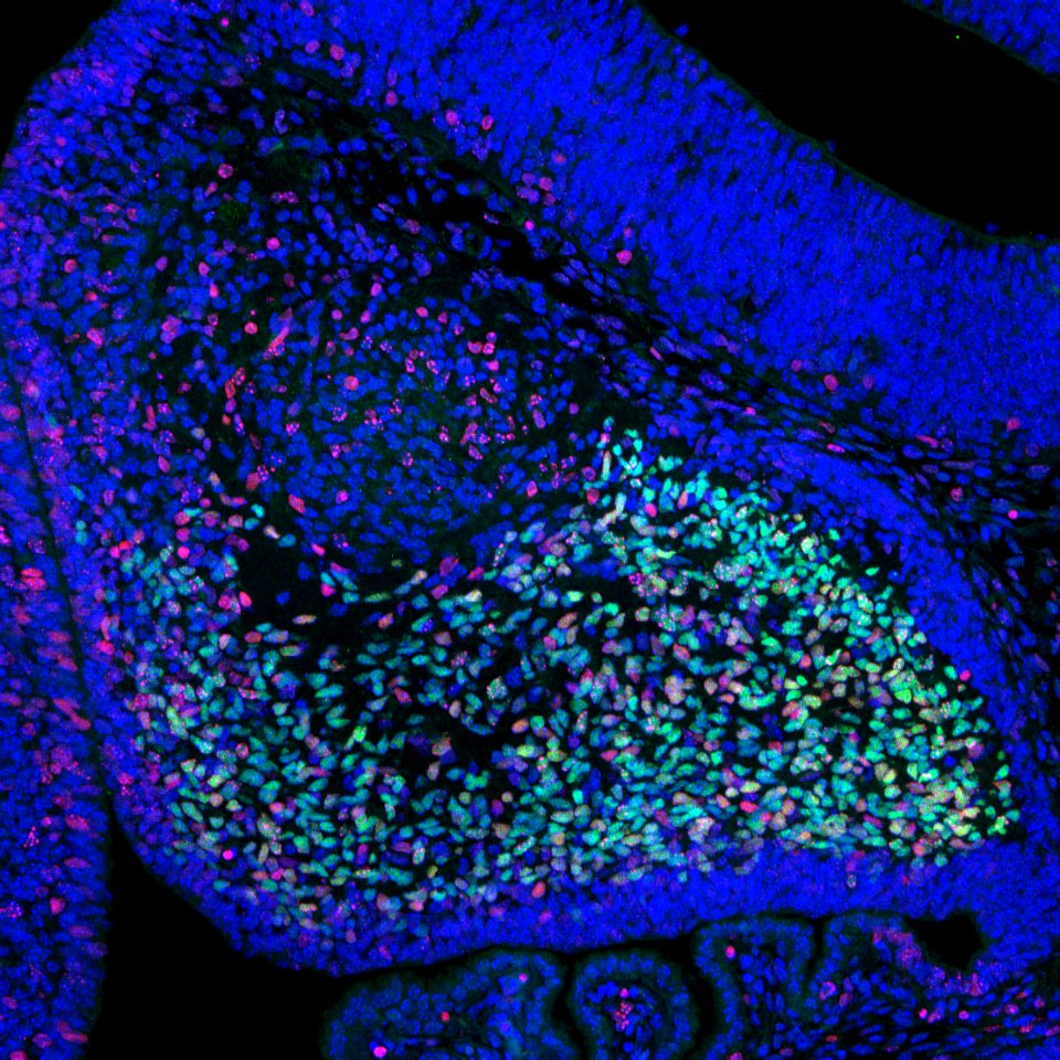Mouse Embryo Cerebellum