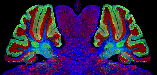 NPC1 Mouse Brain photo