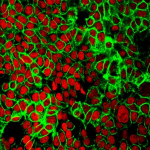 Human Colon Cancer Cells photo