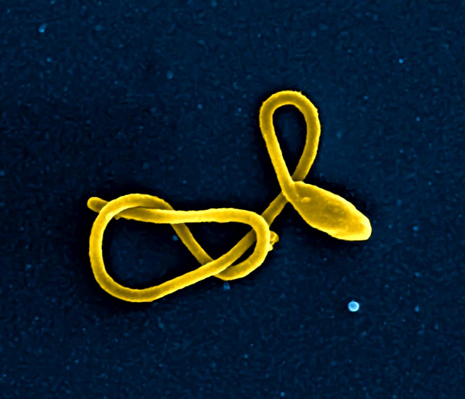 Ebola Virus Particle
