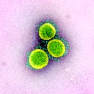 Novel Coronavirus SARS-CoV-2 photo