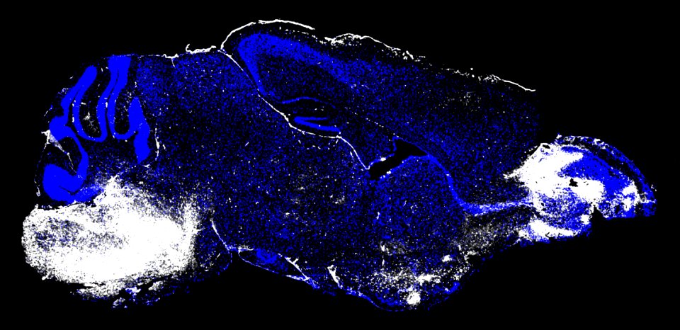 Mouse brain with cerebral malaria