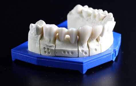 Tooth replacement tooth dental technician