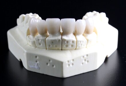 Tooth replacement tooth dental technician