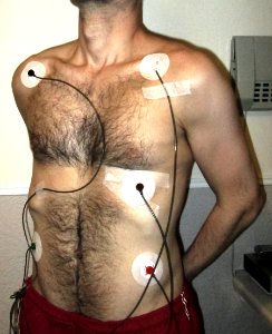 Electrocardiogram photo