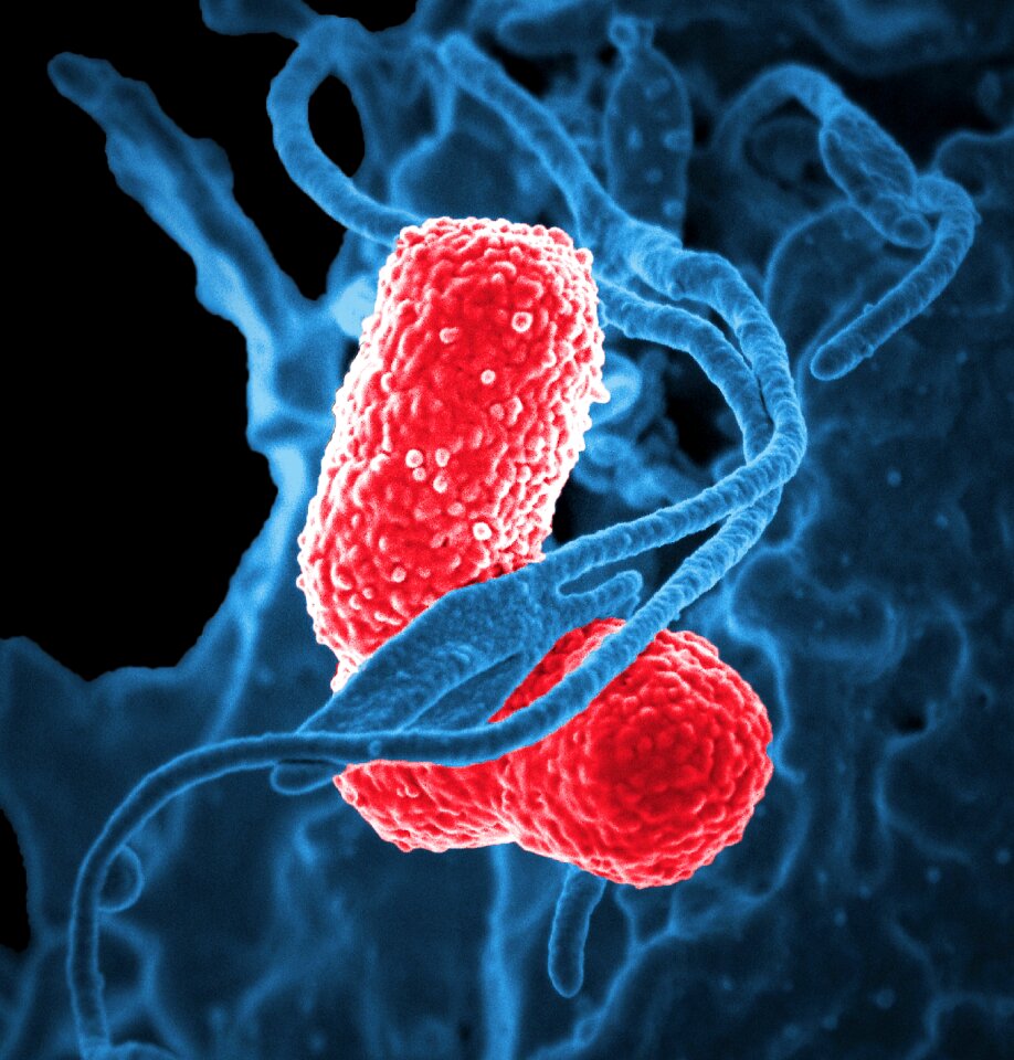 Stained red pneumonia bacterium