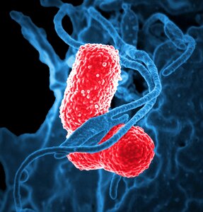Stained red pneumonia bacterium photo