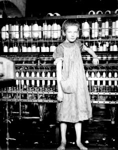 Child Labor:  Barefoot Girl in Factory.