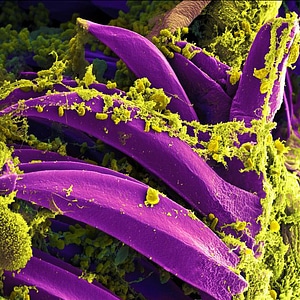 Bubonic plague y pestis bacterium photo
