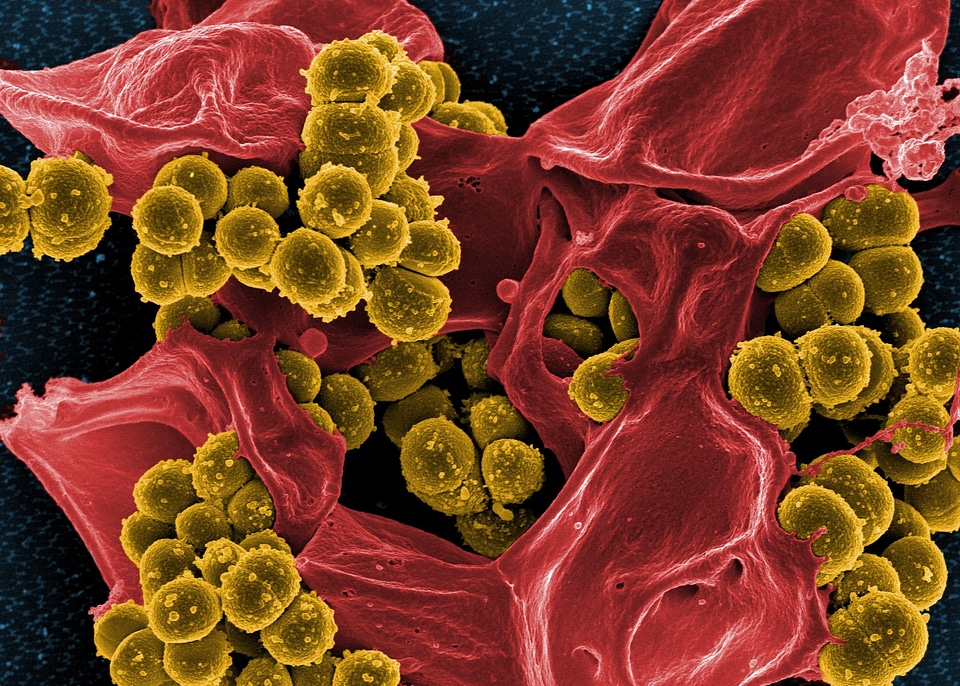 Green staphylococcus aureus spheroid