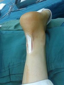 Medicine anatomy injury