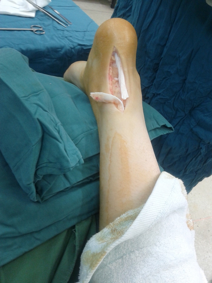 Medicine anatomy injury
