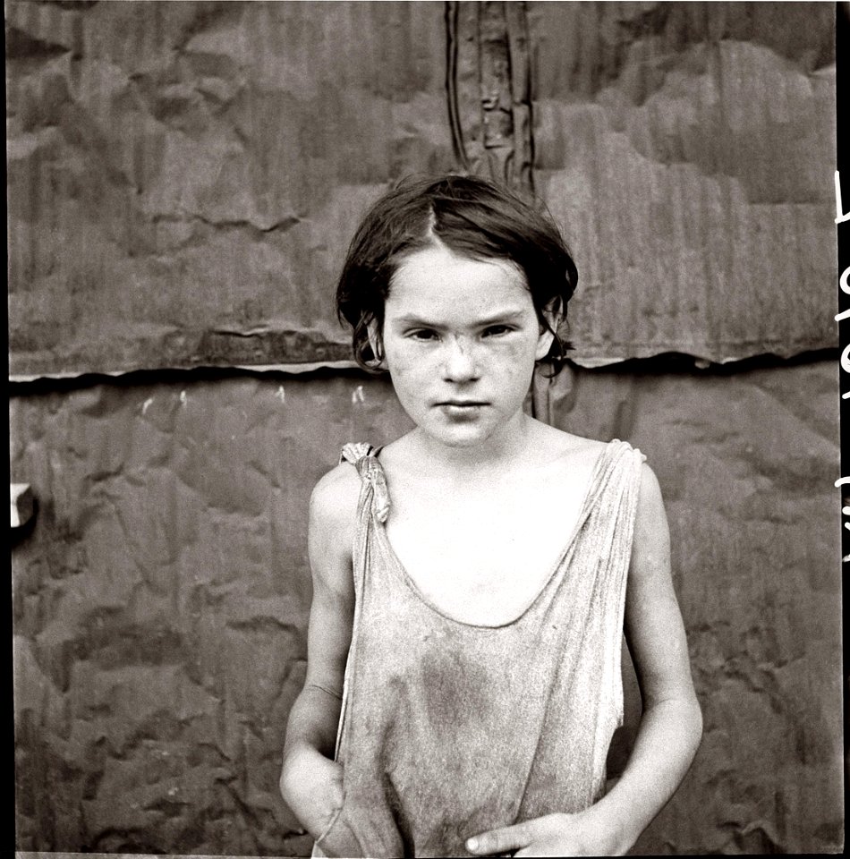 Poverty:  "Damaged Child," Oklahoma City, OK, USA, 1936.