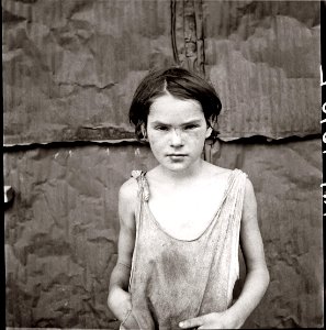 Poverty: "Damaged Child," Oklahoma City, OK, USA, 1936. photo