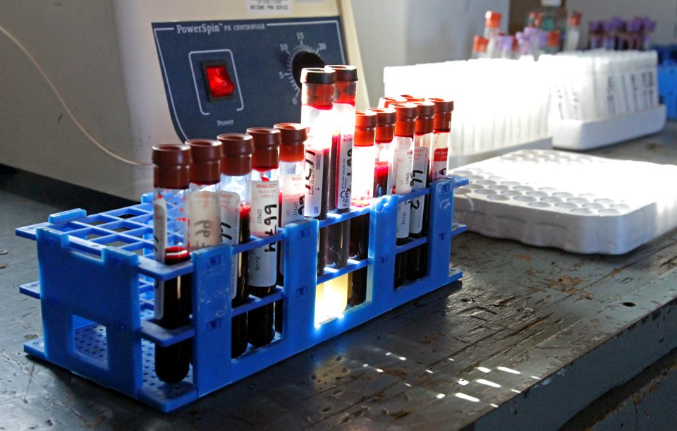 26 of 35 Bison blood vials at Stephens Creek bison pens 3601