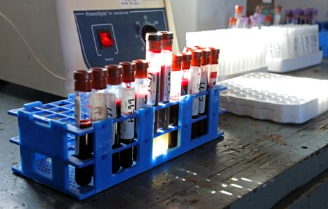 26 of 35 Bison blood vials at Stephens Creek bison pens 3601