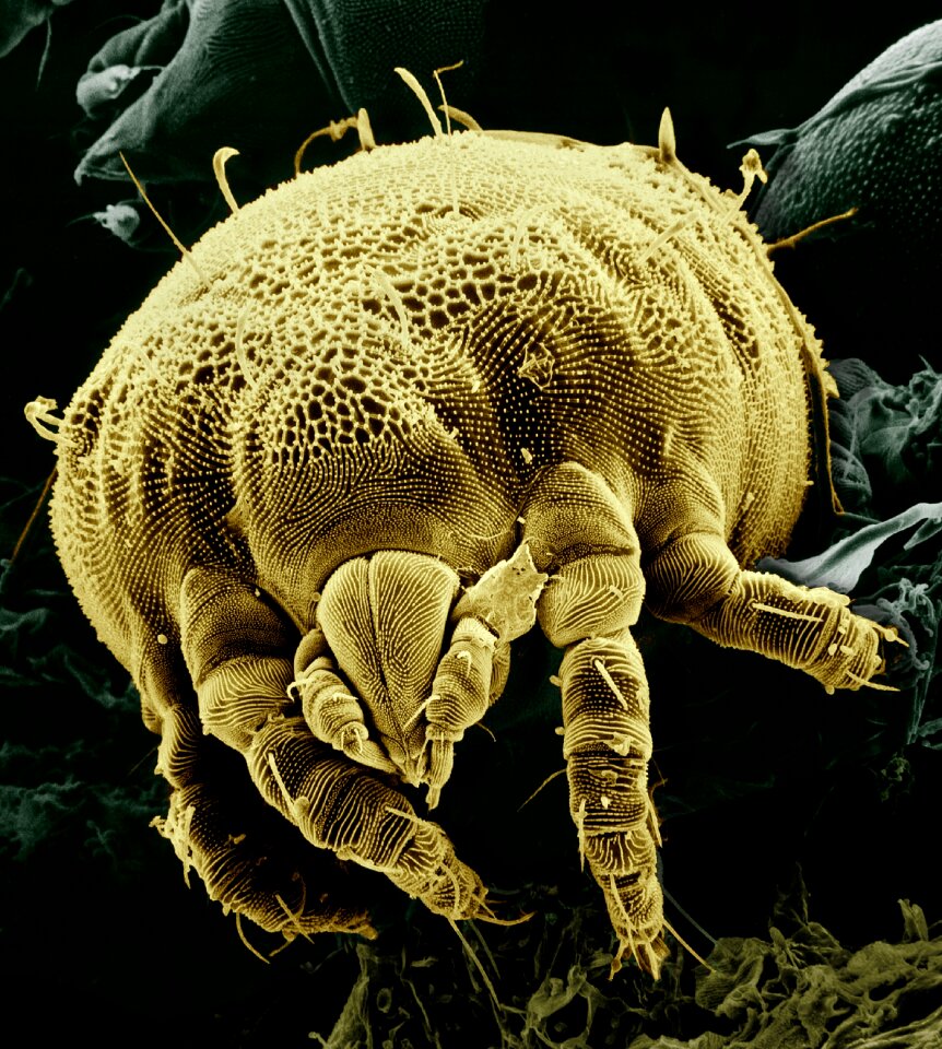 Magnified acariform lorryia formosa