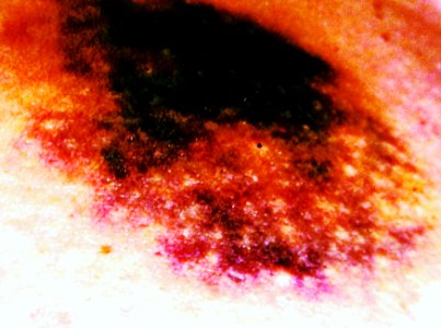 Darkness Inclusion