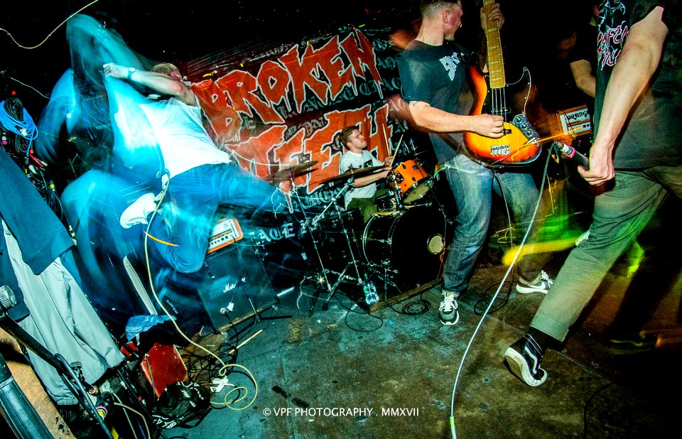 BROKEN TEETH
