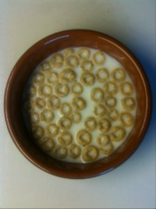 3. Red blood cells showing signs of yeast