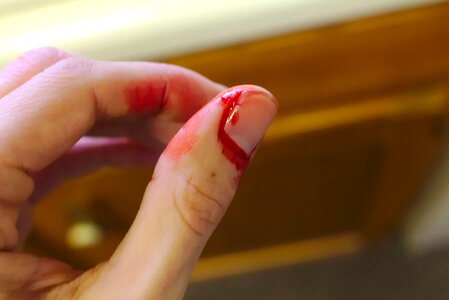 Bleeding finger blood sink